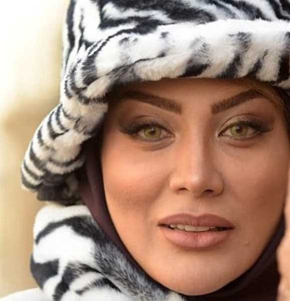 عکس زهرا جهرمی قبل عمل